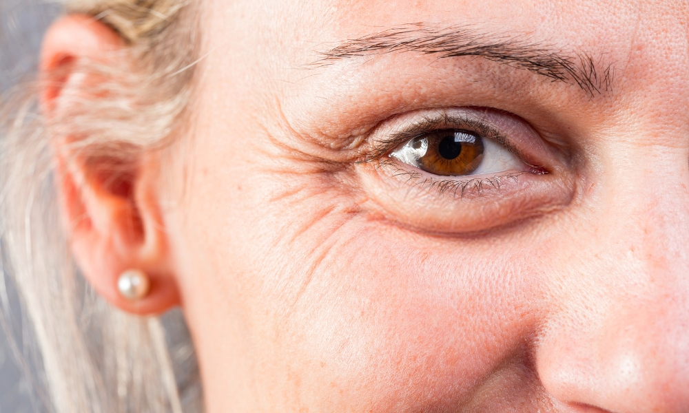 Retinol poboljšava teksturu kože, smanjuje bore i fleke, čisti pore i vraća mladalački sjaj